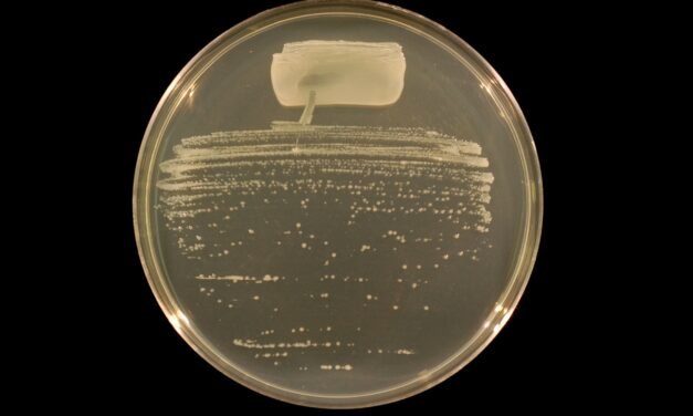 Isolation and mass multiplication of rhizobium