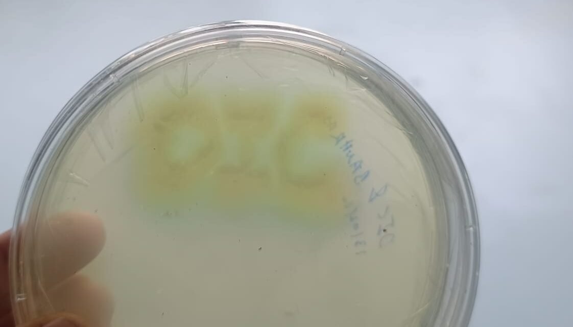 Bacterial Art